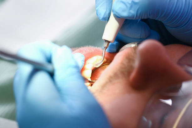 Best After-Hours Emergency Dentist in Glenwood, AR