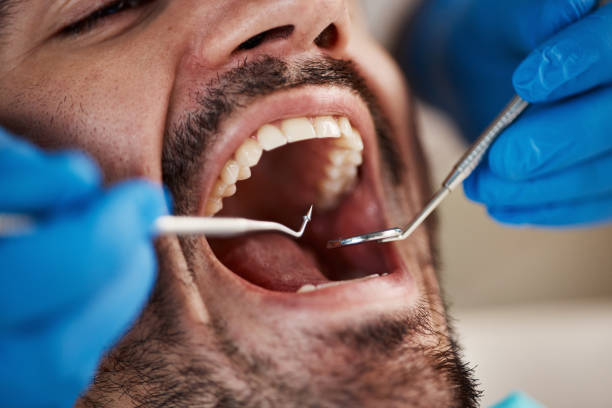 Best Same-Day Emergency Dentist in Glenwood, AR