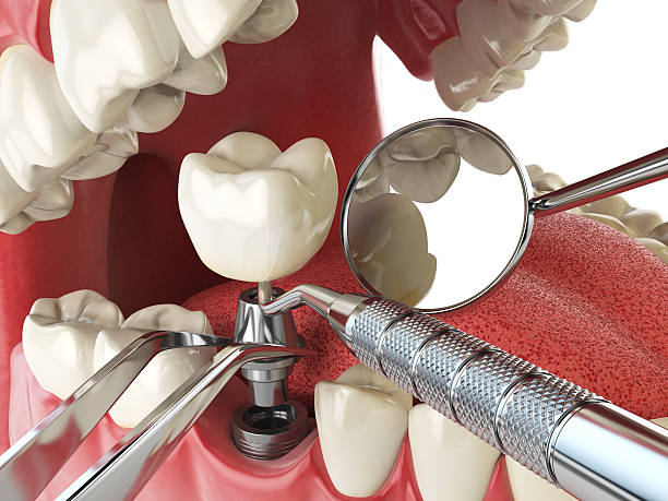 Best Walk-In Emergency Dentist in Glenwood, AR